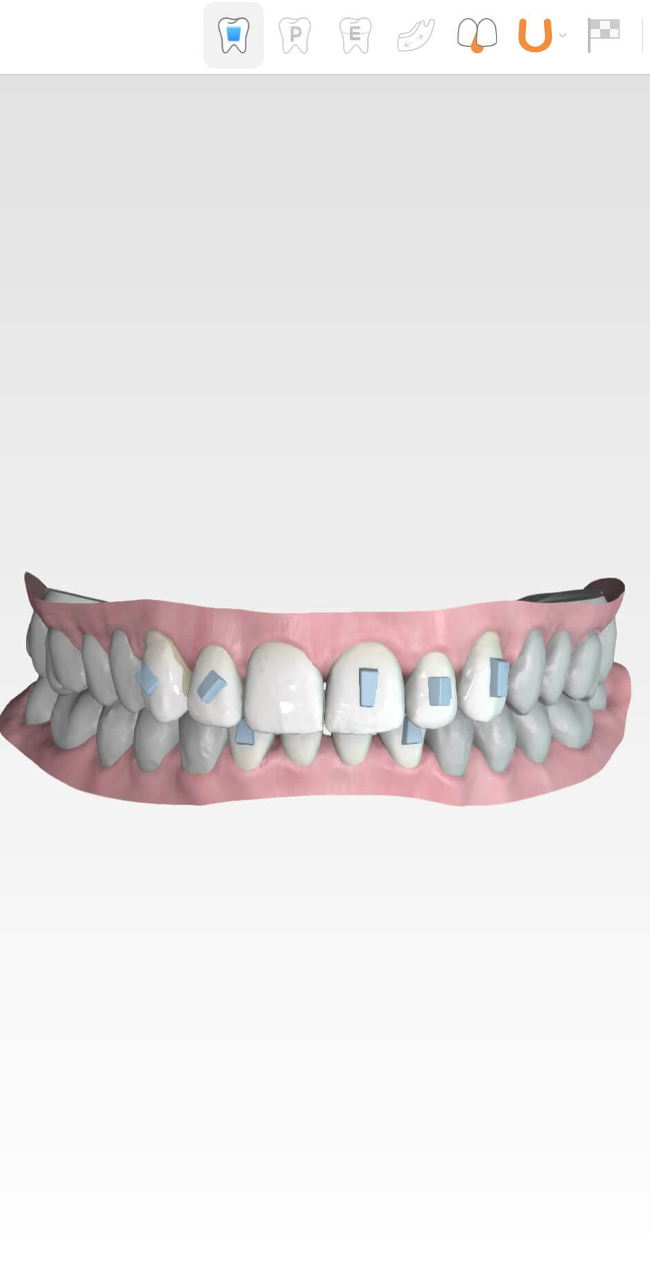 3D Behandlungsplan