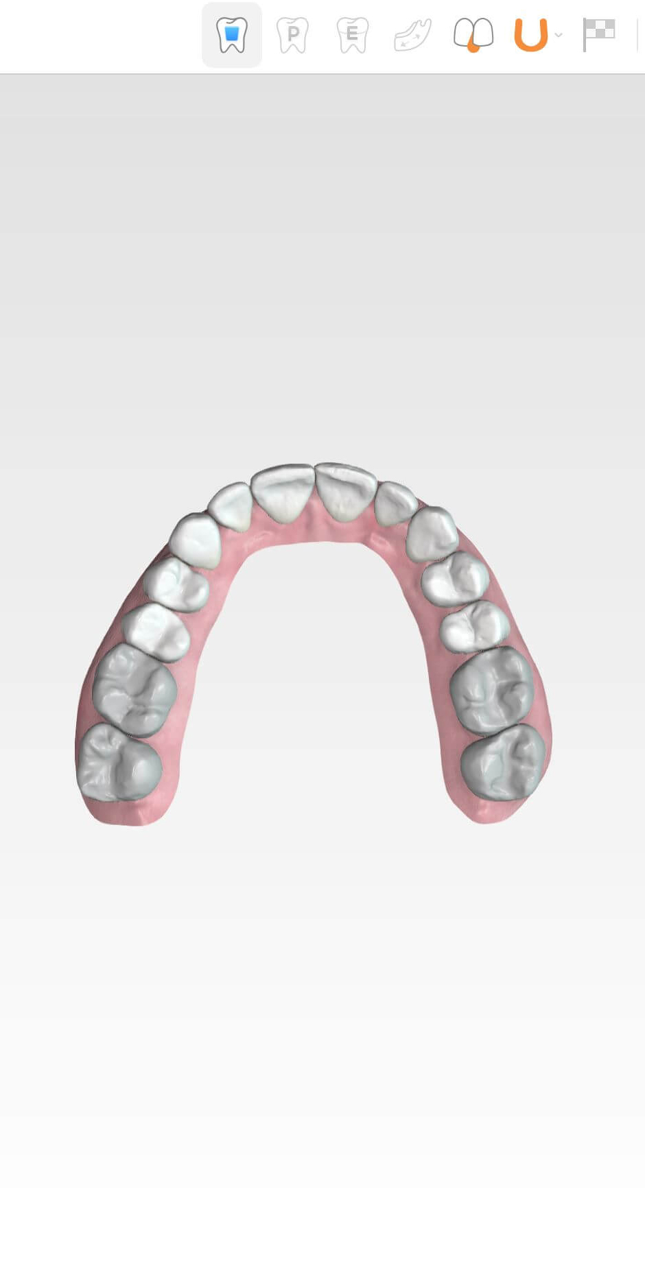3D Behandlungsplan
