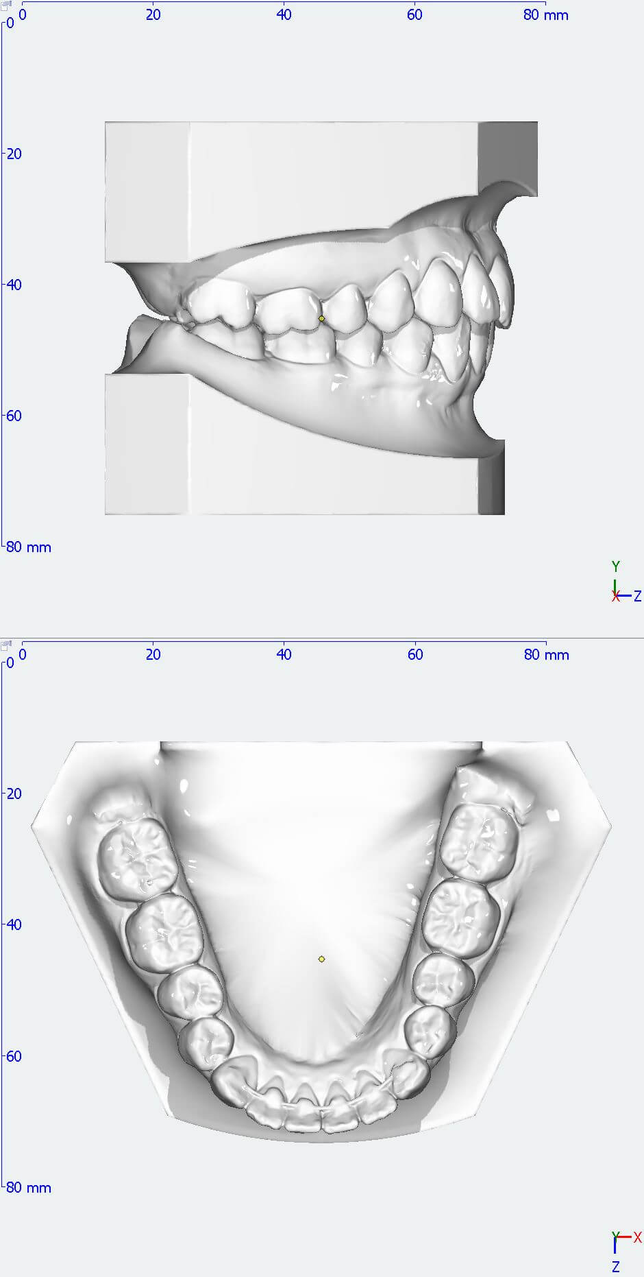 3D Kieferscan
