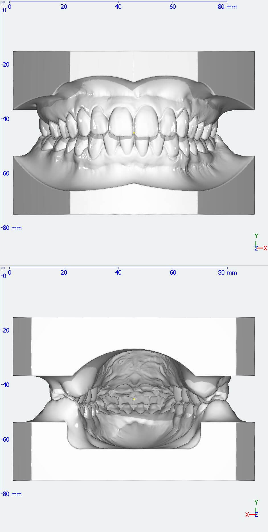 3D Kieferscan