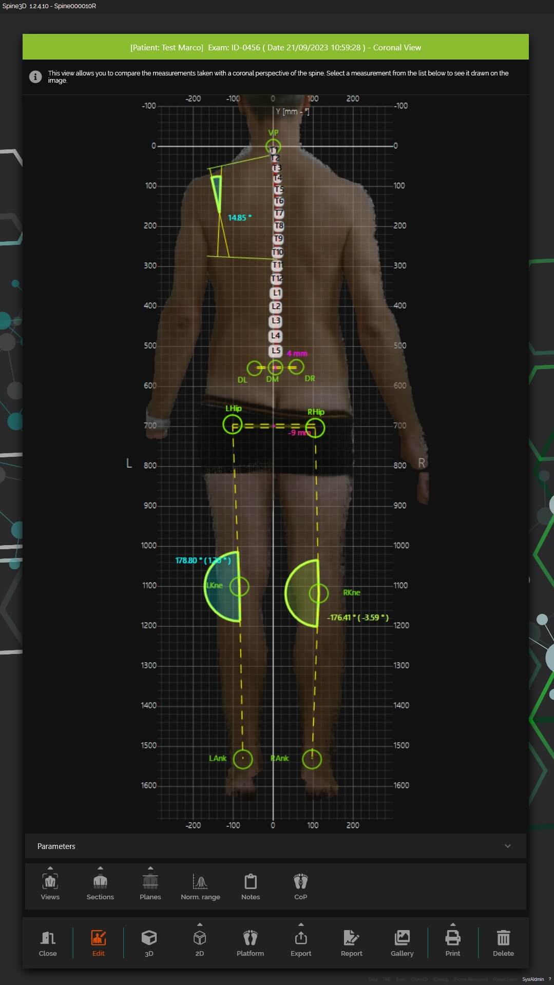 3D Posturanalyse Wien
